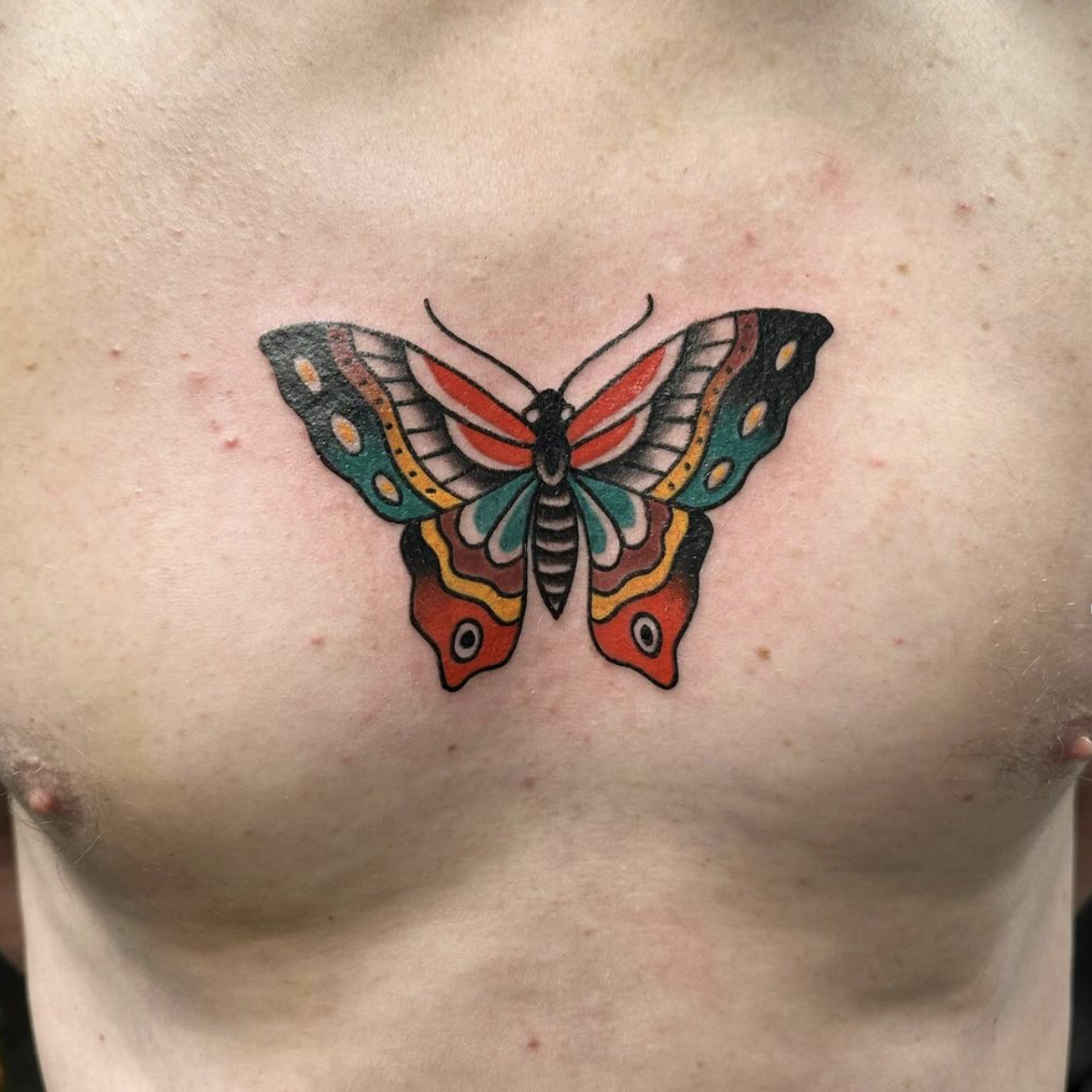 Butterfly on sternum